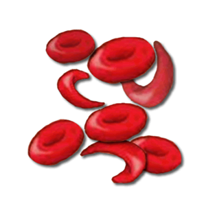 Normal and Sickle Blood Cells